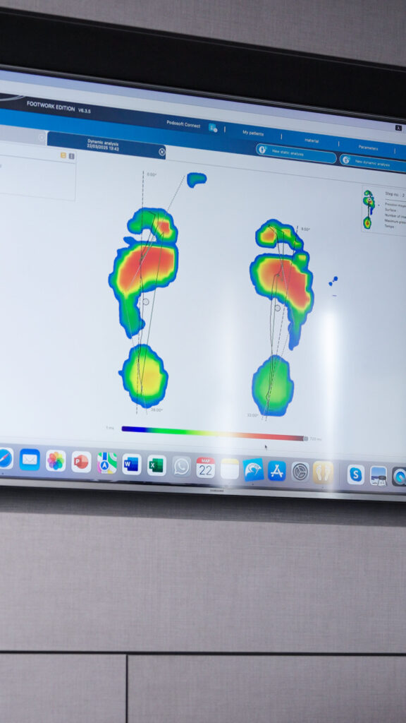 Ψηφιακό Πελματογράφημα